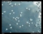 Staphylococcus epidermidis colony morphology